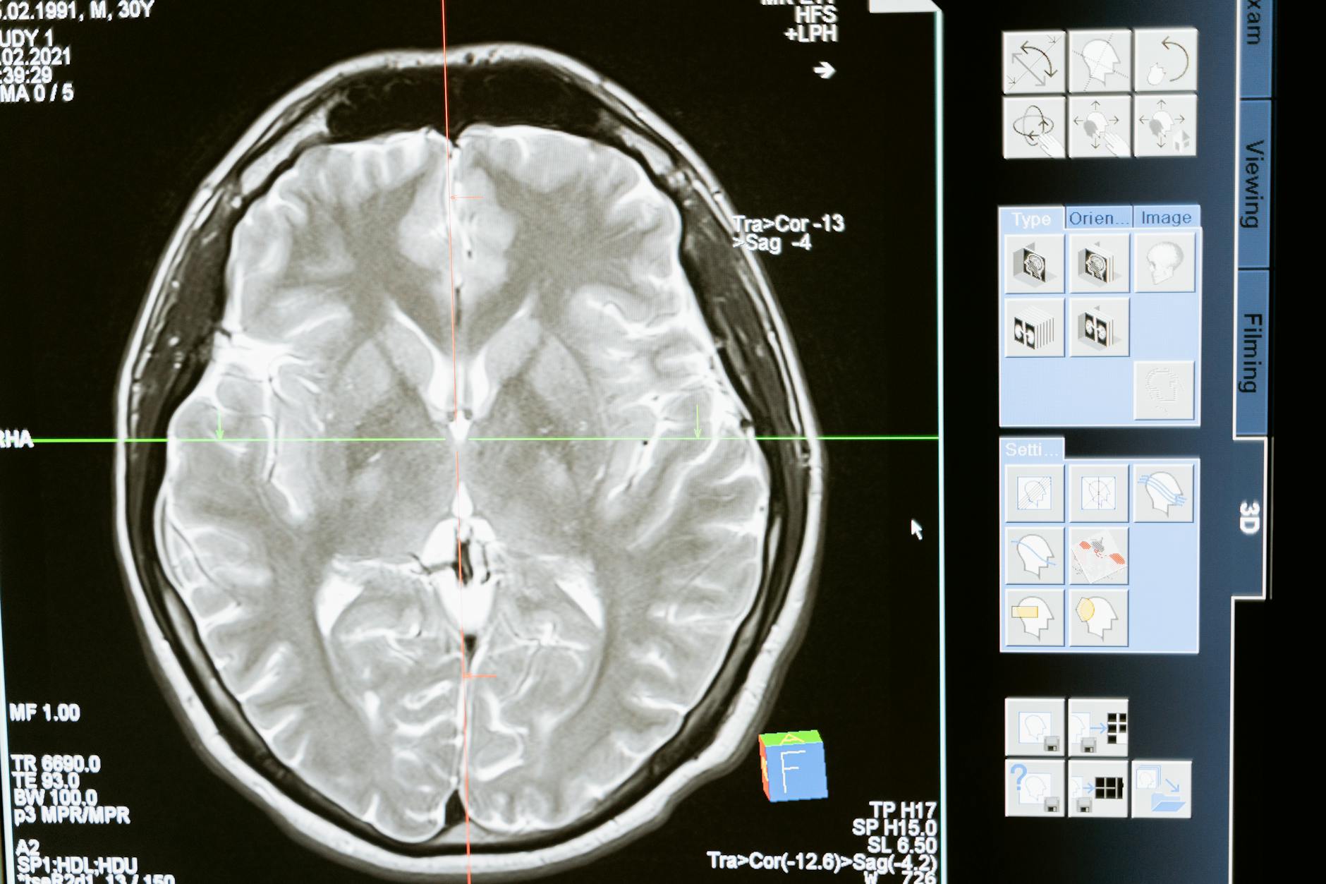 Cerebras Just Pulled Biggest IPO Momentum: What Now