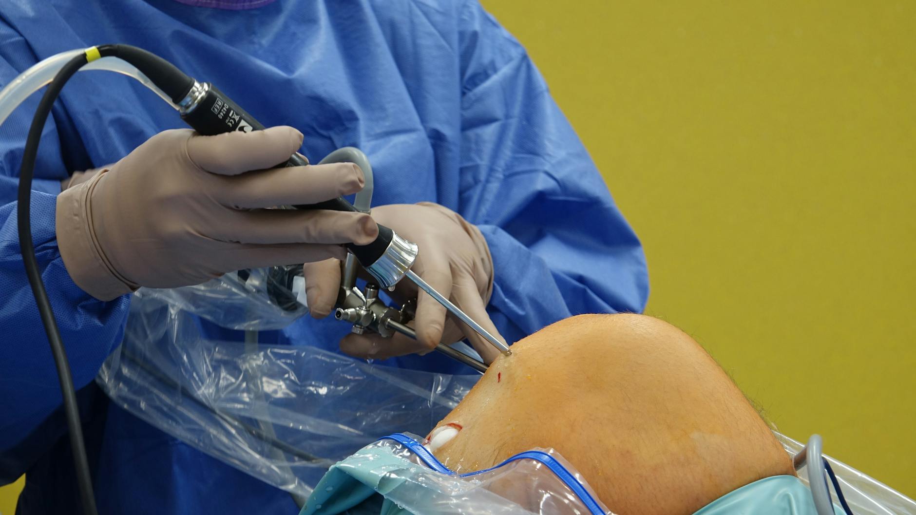 Intuitive Surgical Dropped This Year: Buy Opportunity?