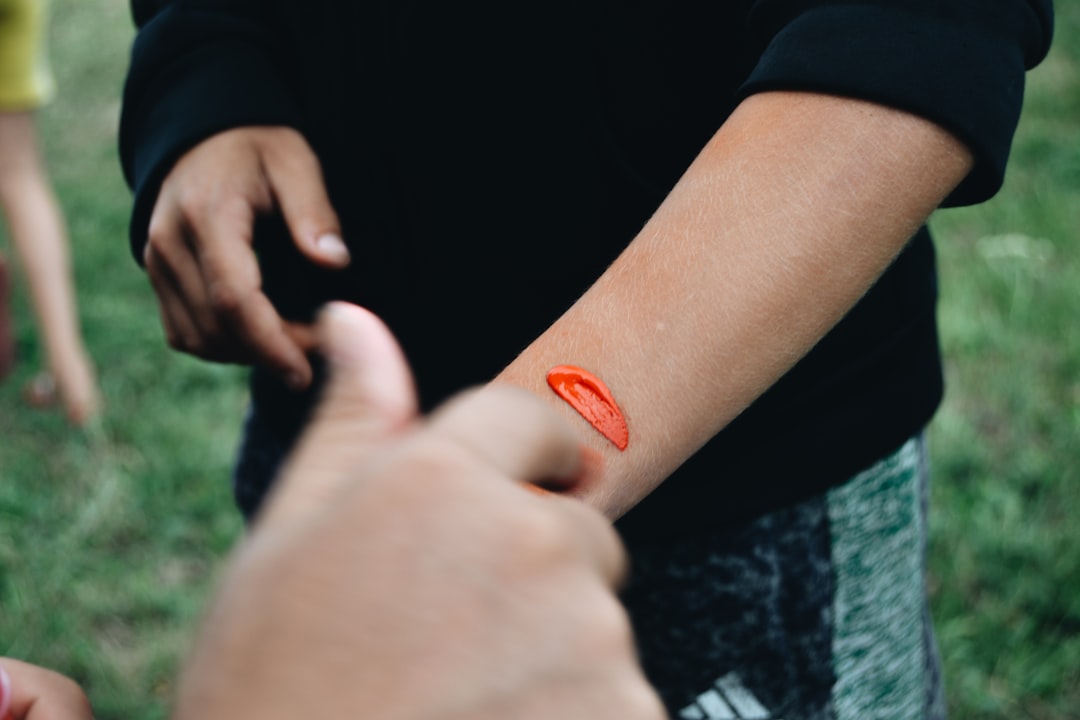 Wrist Injury Derailed College Plans and Fueled CEO Rise