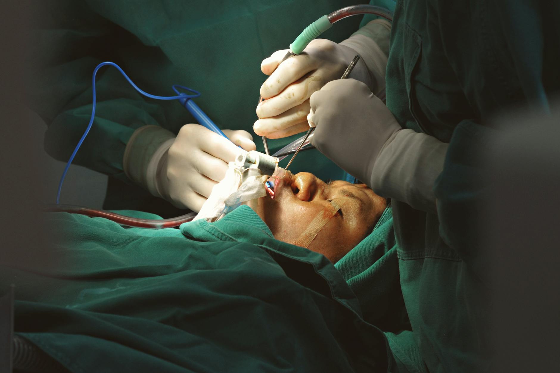 401(k) Move Surgeons Zero Taxes on Early Retirement Income