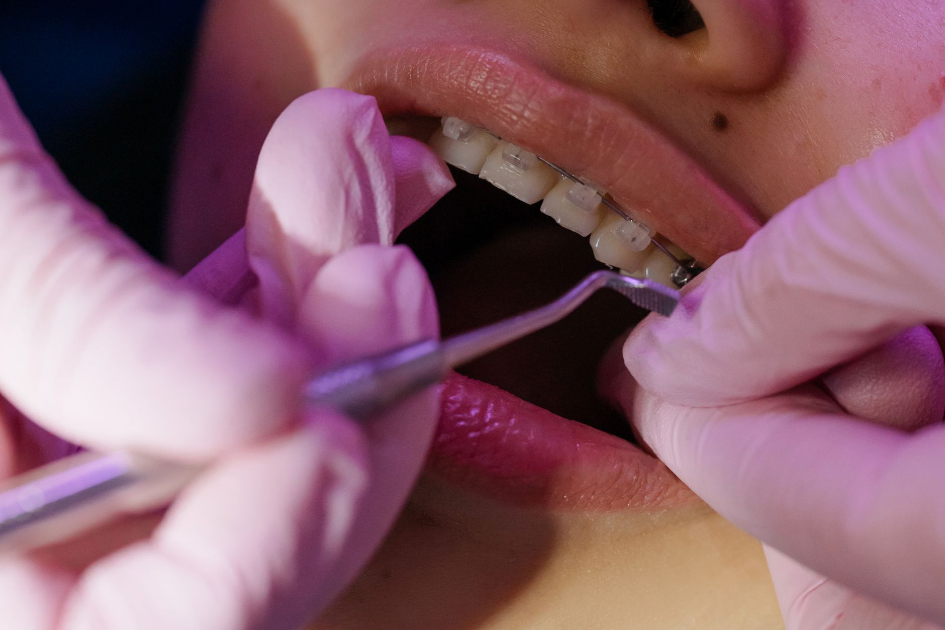 Don’t Your Kids’ Braces Derail Retirement: Dividend Strategy