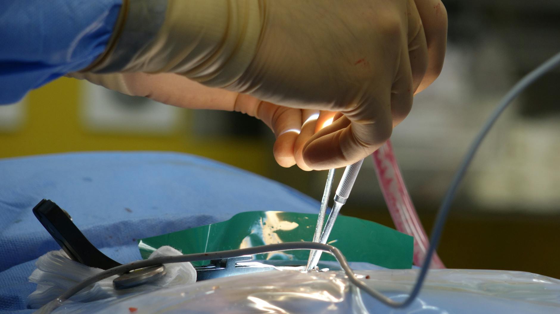 Surgical Robotics Meets Intuitive: AI Boosts MedTech Stocks