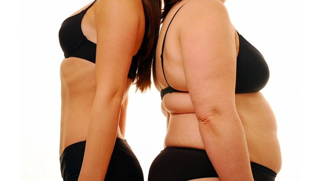 OBEZITATEA INFANTILĂ, determinată de la o vârstă foarte fragedă