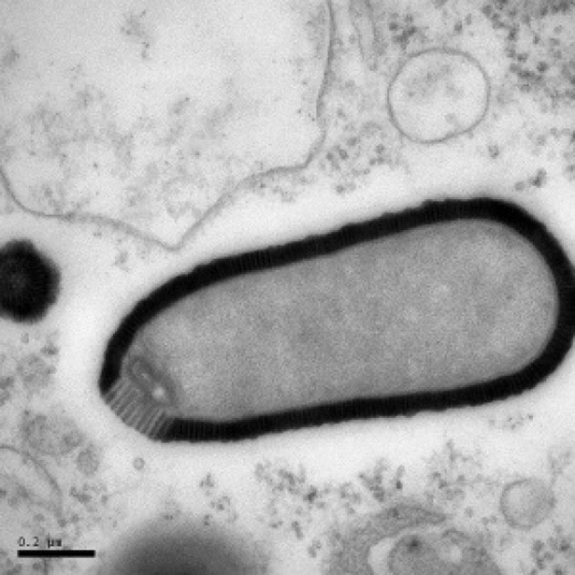 Un virus reinviat dupa 30.000 de ani ameninta omenirea