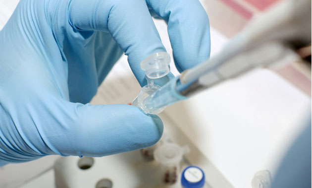 STUDIU: Mutaţiile unei gene reduc cu 40% riscul de boli cardiovasculare