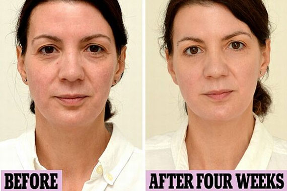 A băut trei litri de apă pe zi timp de o lună și arată cu zece ani mai tânără