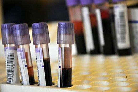 Numărul cazurilor de cancer va crește cu aproximativ 70% în următoarele două decenii