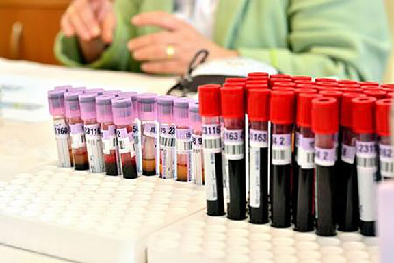 Oboseala cronică este o maladie biologică și nu psihologică