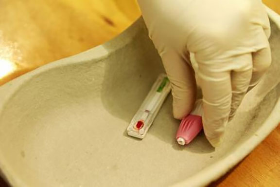 Hepatita C: 75% dintre cei infectați nu știu că se află în această situație