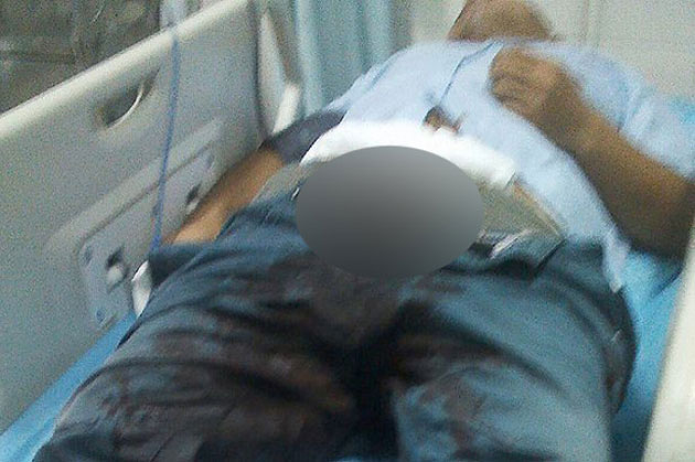 A vrut să-şi taie penisul  cu un cuţit