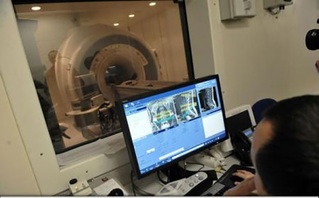 Un accident vascular cerebral este echivalent cu opt ani de îmbătrânire prematură