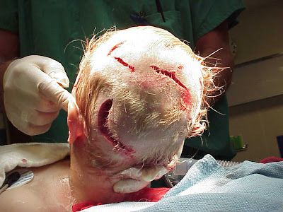 Un SĂTMĂREAN a fost SCALPAT de un CAL. Alţi cinci au fost MUŞCAŢI de câini