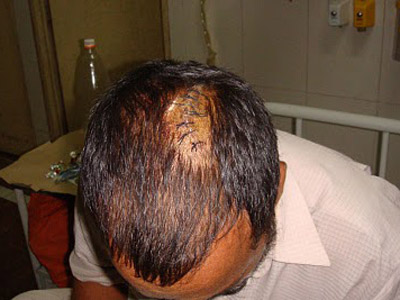 LOVIT cu STICLA în CAP în PROPRIA-I casă