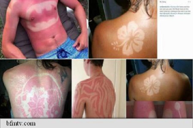 Arsurile solare în scop artistic, o practică la modă, dar foarte periculoasă