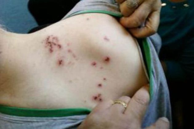 Ca-n EVUL MEDIU. Copil de 6 ani, MUŞCAT de ŞOBOLANI la Sătmărel