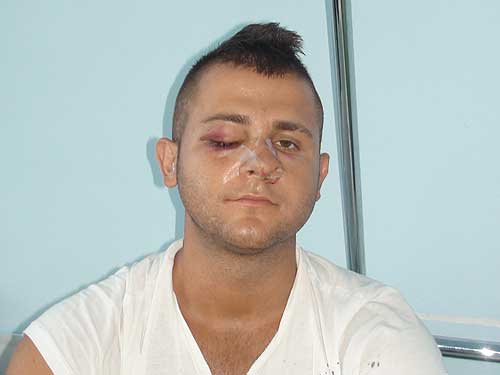 Un bărbat a încercat să îşi OMOARE FRATELE la Moftin