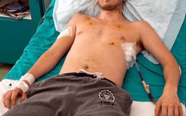 TÂNĂR bătut măr şi ÎNJUNGHIAT, abandonat pe stradă în municipiul SATU MARE