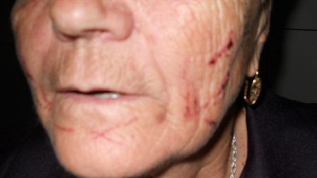 Bătrână bătută de trei huligani