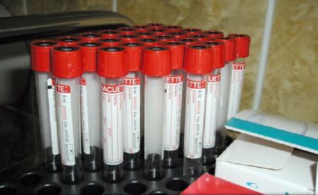 Număr record de infecții cu virusul SIDA în Europa și în Asia Centrală în 2014 (UE și OMS)