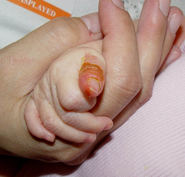 COPIL de un an şi trei luni, MUŞCAT de ŞOBOLANI. Micuţul, INTERNAT la Boli Infecţioase