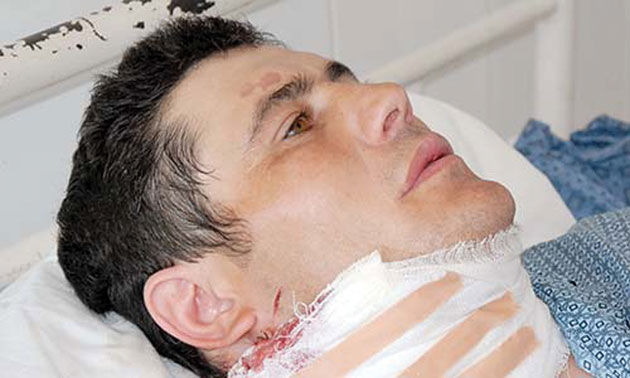 Scandaluri cu răniri grave la Carei şi Prilog