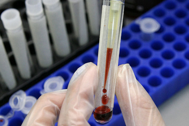 Ministrul Sănătăţii despre ancheta din Argeş: Rezultatul de până acum este doar o mică fotografie