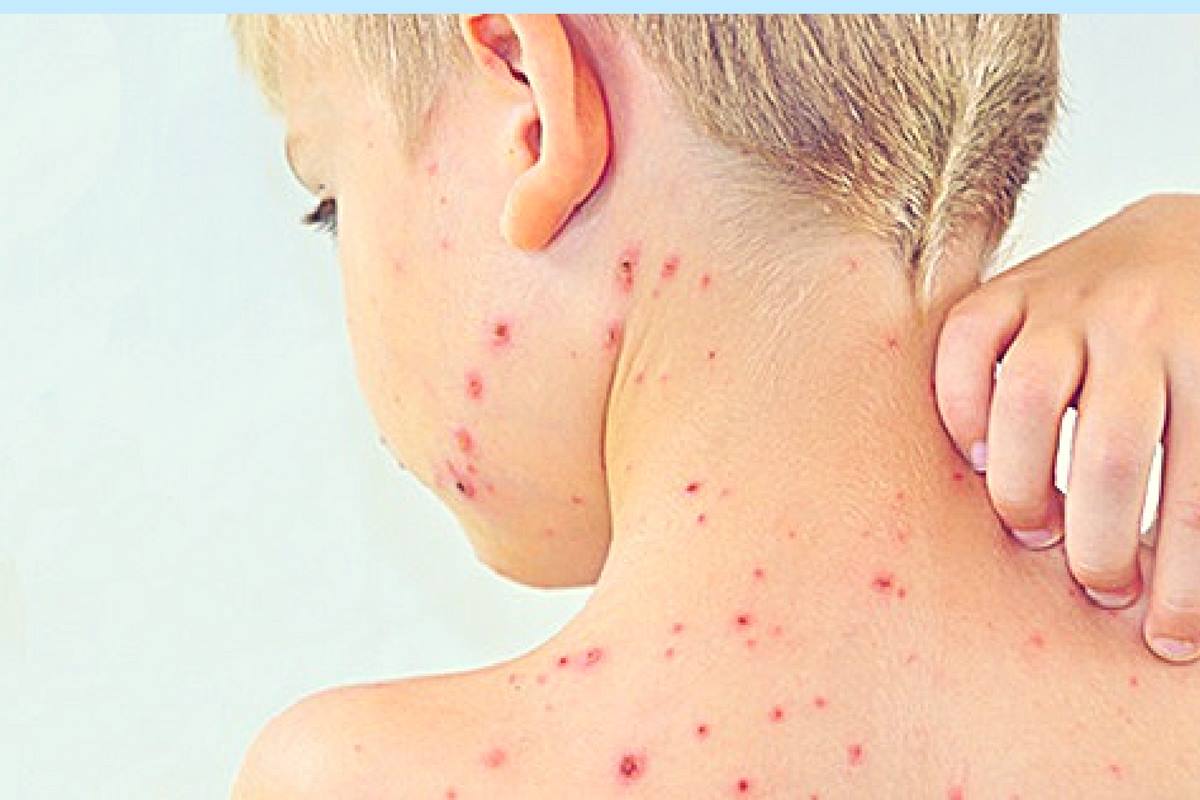 ALARMĂ!!! O BOALĂ cruntă, mai ales la COPII, face RAVAGII la Satu Mare. Locul DOI  pe țară