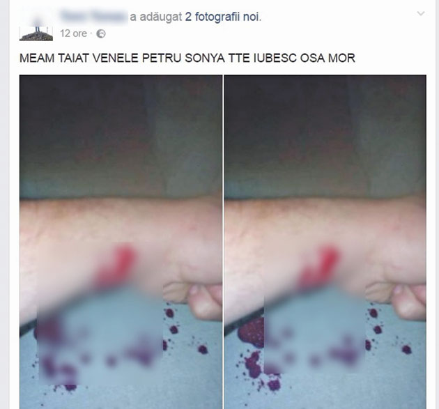 Un adolescent și-a tăiat venele în direct pe Facebook