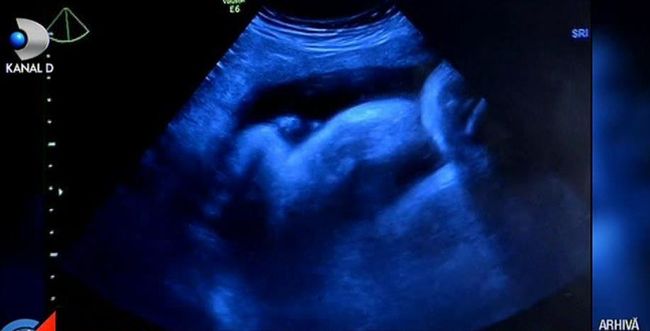 Conducerea Spitalului din Negrești spune că s-a procedat corect în cazul copilului decedat