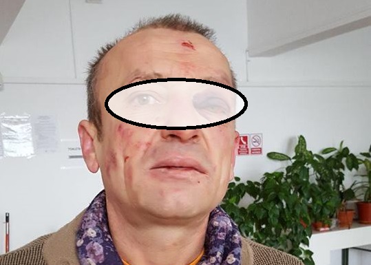 FOTOGALERIE. Bătut cu bestialitate timp de o oră de patru agresori. A fost și tâlhărit