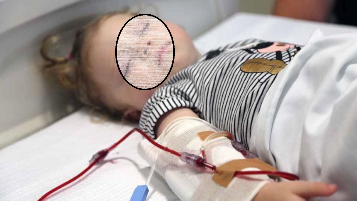 APEL umanitar disperat. Un copilaș din Satu Mare are nevoie de sânge