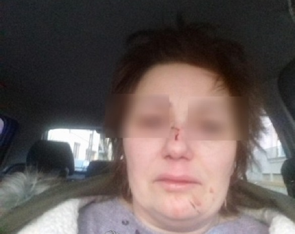 FOTO. Femeie desfigurată în stradă, în fața unui copil de grădiniță. Motivul, uluitor