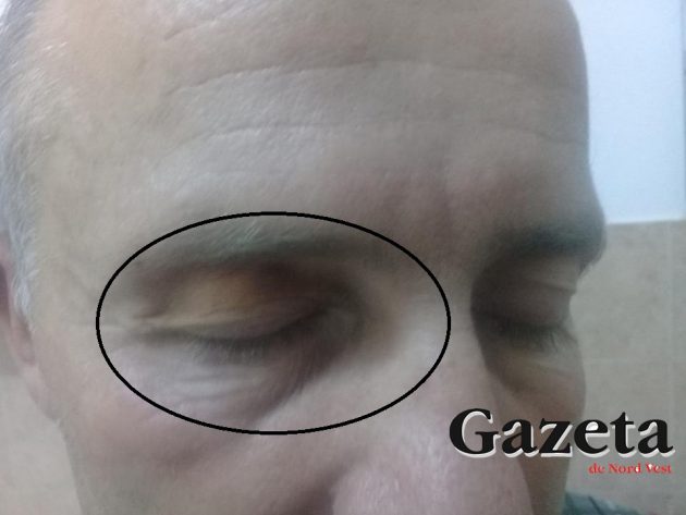 FOTO. Scandal la Spitalul Județean. Acuzații: pacient bătut cu bestialitate