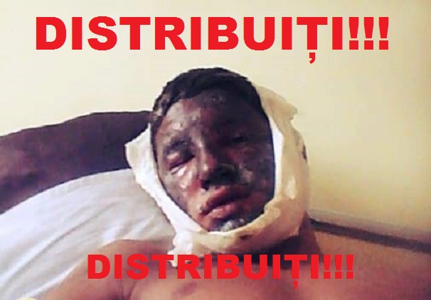 FOTO. APEL UMANITAR. Acest tânăr are NEVOIE de noi toți să SUPRAVIEȚUIASCĂ