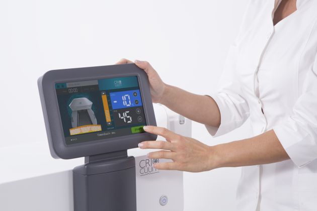 Criolipoliză la Pearl Beauty Center, cu până la 45% mai puțină grăsime!