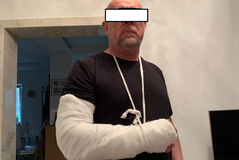 FOTO. Polițist ACUZAT că i-a RUPT MÂNA în două locuri unui negreștean