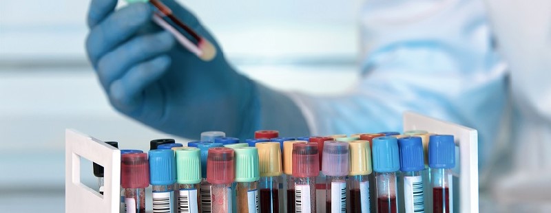 Peste 10 mii de teste, făcute la Satu Mare