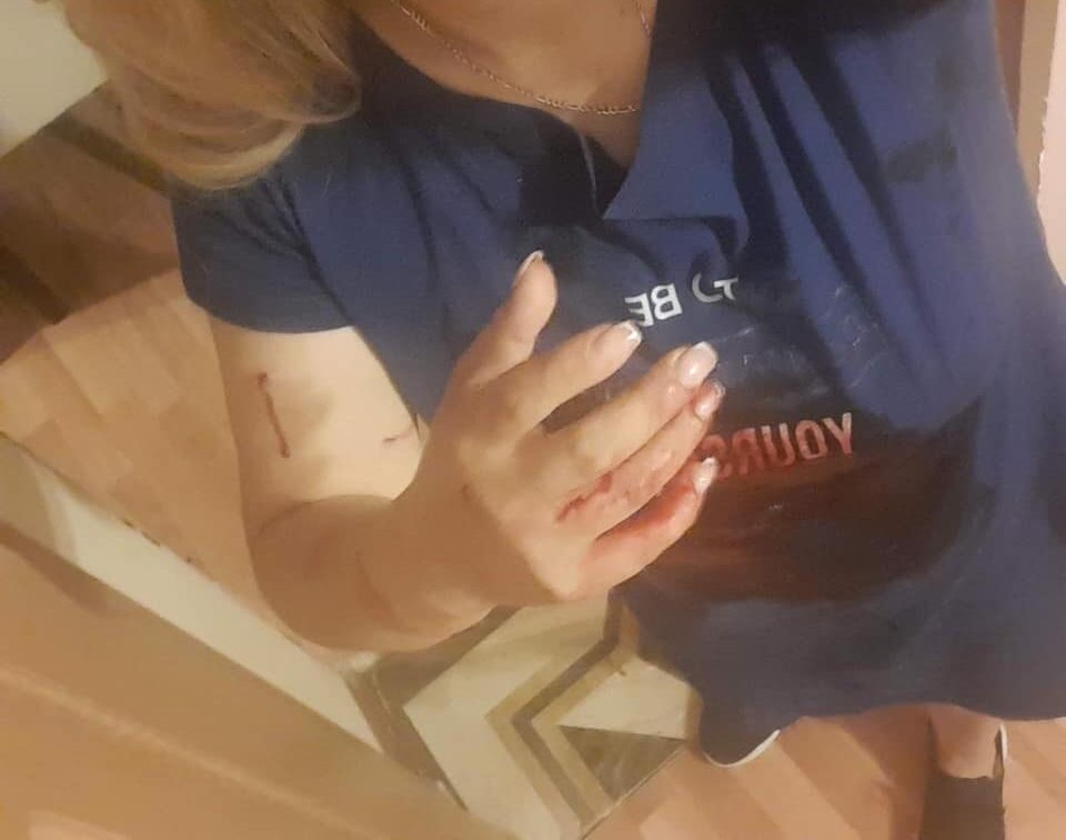 TENTATIVĂ DE CRIMĂ. Bătaie de o cruzime rară. Luptător în cușcă și-a băgat în spital soția și soacra.