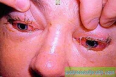 ALARMĂ!!! BOALA  a REAPĂRUT în județ. Poate fi MORTALĂ