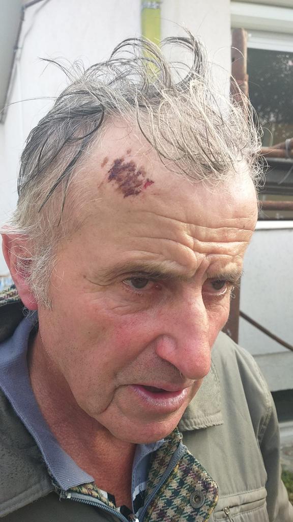 PLÂNGERE. Un bixădean susține că a fost bătut de către primar