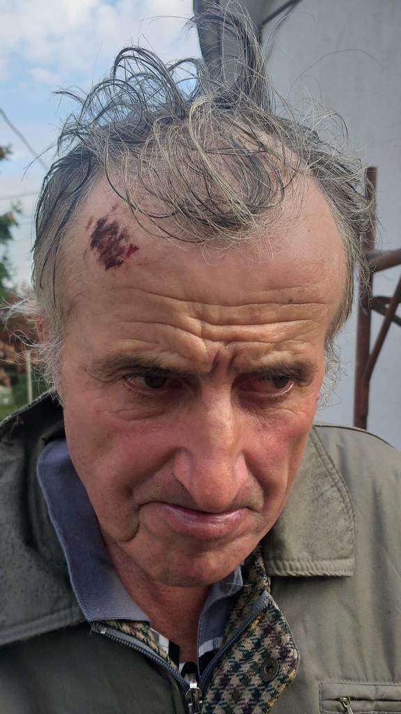 Ghere Grigore a răspuns acuzelor aduse de primarul comunei Bixad în legătură cu cazul cetățeanului lovit zilele trecute