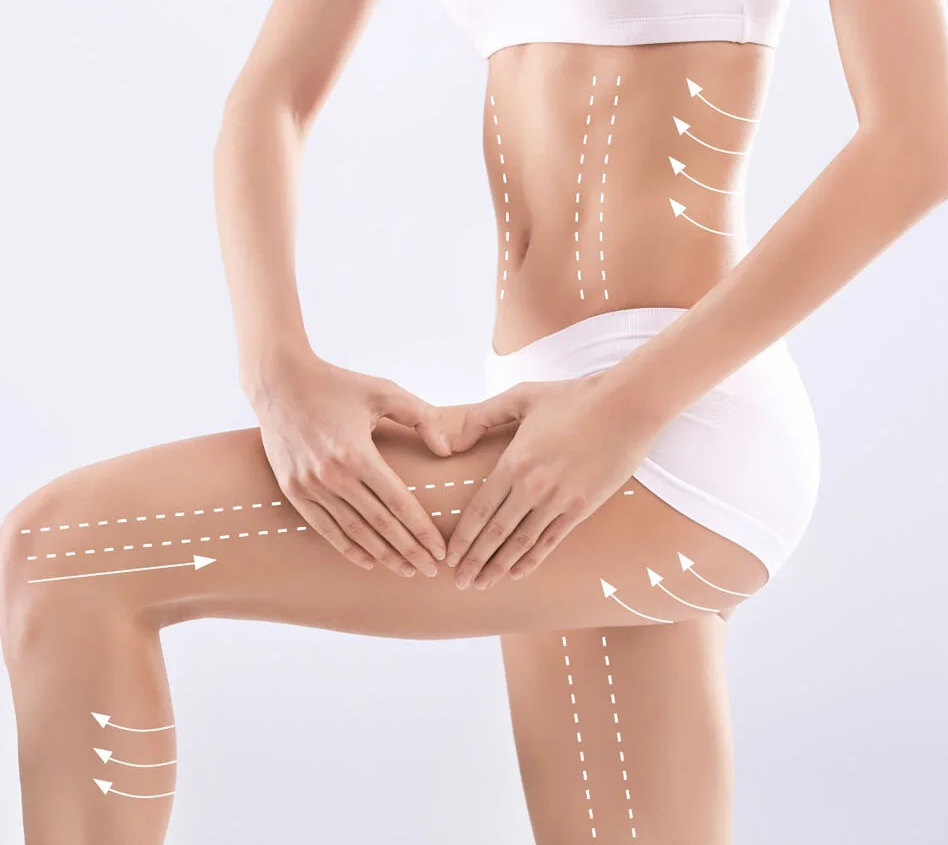 3 atuuri ale femeilor care apeleaza constant la procedura de remodelare corporala