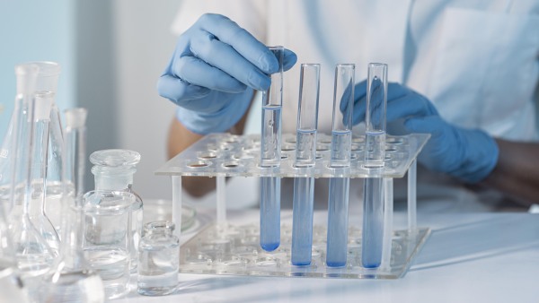 Laboratorul de Chimie Sanitară și Toxicologie Industrială raportează rezultatele analizelor din perioada ianuarie 2024