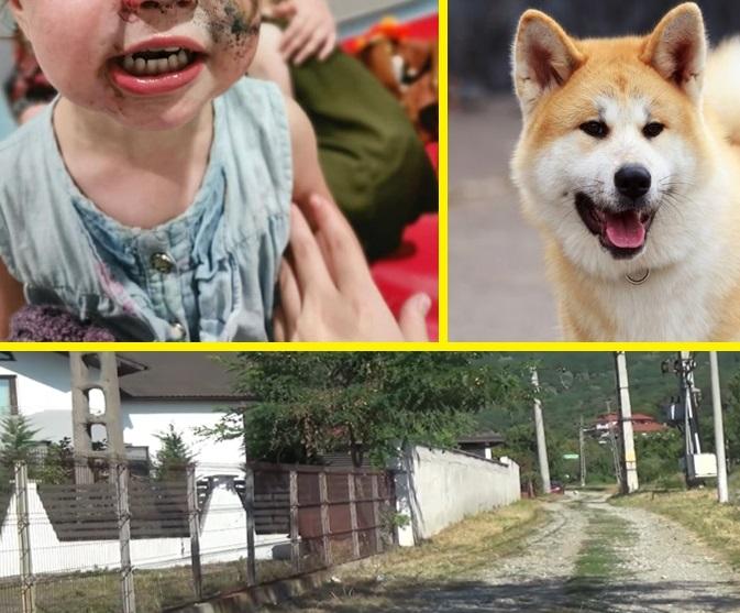 Fetiţă de doi ani muşcată de câini în propria curte